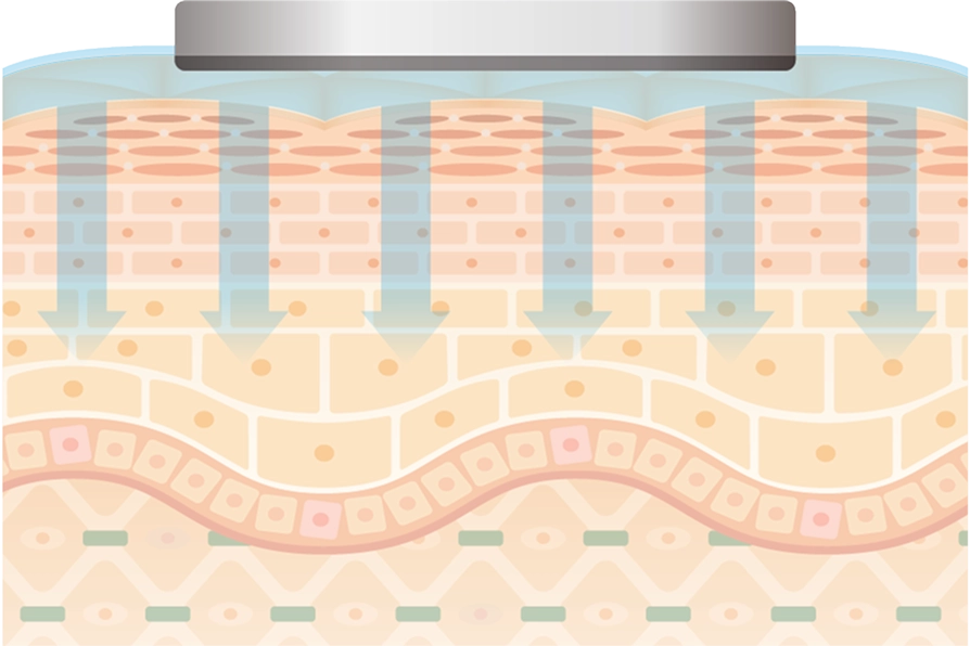 イオン導入でのケア